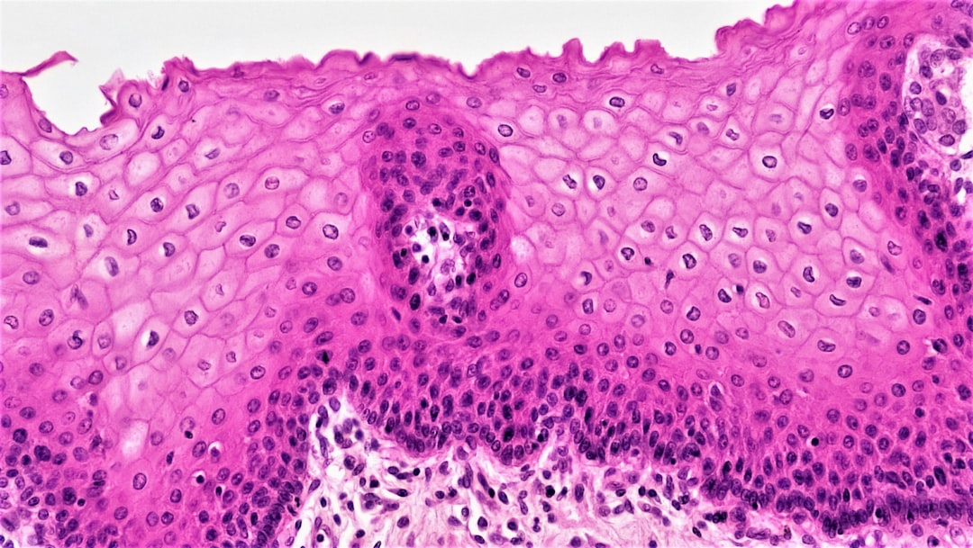 Controversy Erupts Over Mesenchymal Stem Cell Trial for Heart Failure